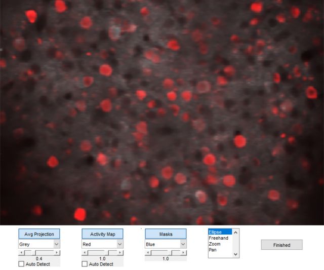 2P Postprocessing
